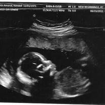 Shannon2_001_1__medium